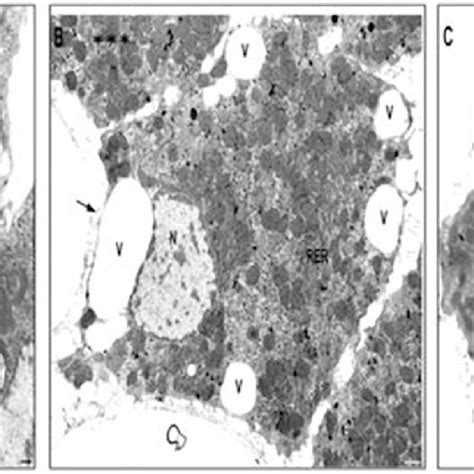 Electron Micrographs Showing The Distribution Of Kupffer Cells In