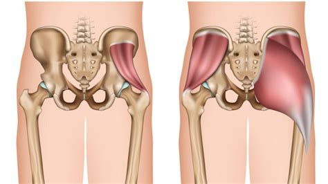 Dolore Al Medio Gluteo