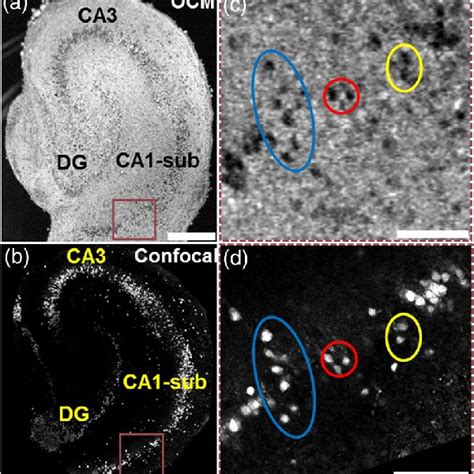 Ultrahigh Resolution Optical Coherence Microscopy OCM Image A And