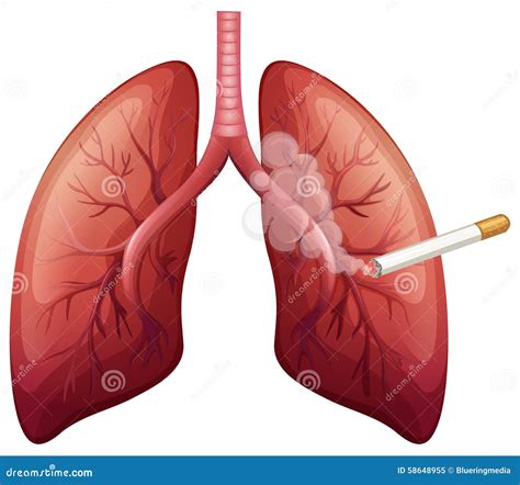 Lung Cancer With Smoke Stock Vector Image