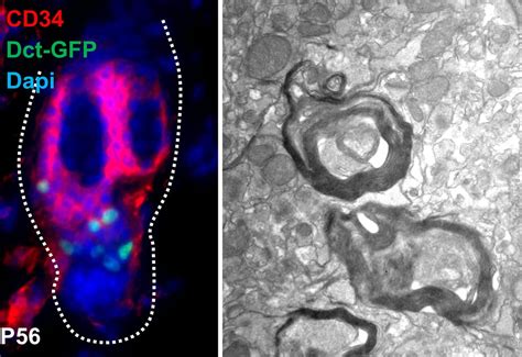 Pigment-producing stem cells can regenerate myelin sheath: Mouse study ...