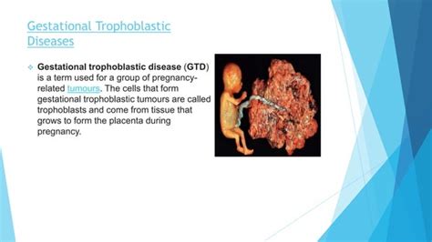 Gestational Trophoblastic Diseases Ppt