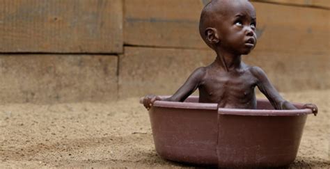 Per Unicef Oltre Milioni Di Bambini Colpiti Da Malnutrizione