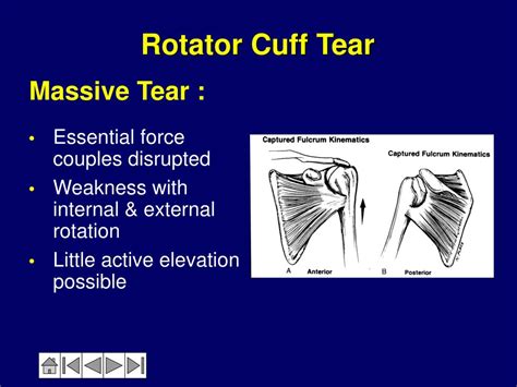 Ppt Anatomy And Biomechanics Of The Shoulder Powerpoint Presentation