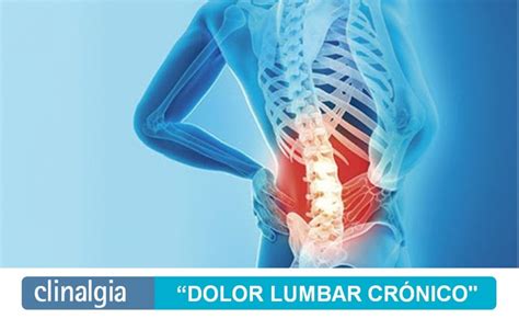 Dolor lumbar Crónico Origen y Tratamiento Clinalgia