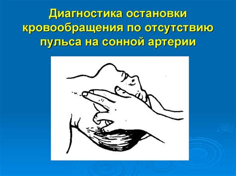 Основы реаниматологии - презентация онлайн