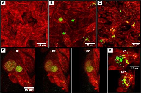 Analysis Of Nanoparticle Uptake By Ovarian Cancer Cells A To E