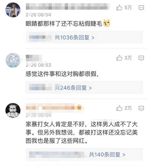 被家暴的网红王瑞儿晒美照，脸上的伤全部消失了