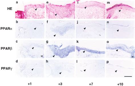 Differential Expression Of Ppar In Adult Mouse Epidermis During