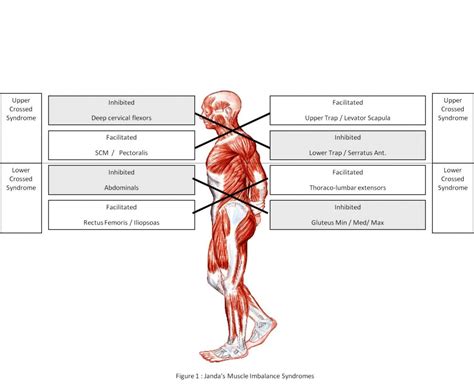 How to prevent and treat muscle imbalance | TFA (Training for Acro)