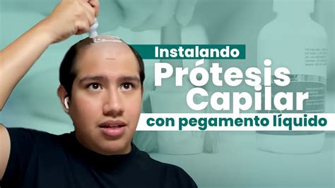 C Mo Instalar Una Pr Tesis Capilar Con Pegamento L Quido Youtube