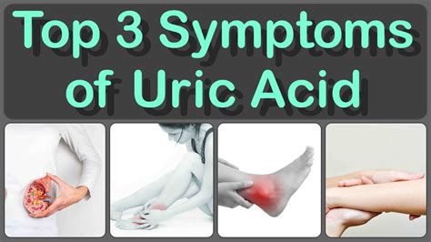 What Is Considered High Uric Acid Level