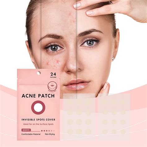 Hydrocolloid Noise＆pimples Patch Acne Treatment For Face Instant And Concealment Easy To Apply