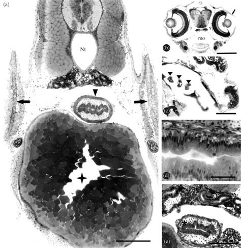 Histological Sections Of Hoplias Lacerdae Larvae A Section Showing Download Scientific