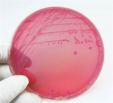 Best Fecal Coliform Bacteria Stock Photos, Pictures & Royalty-Free Images - iStock