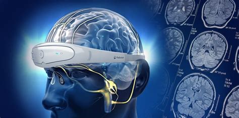 Neurolief Announces Positive Results From Brain Neuromodulation Therapy Trial