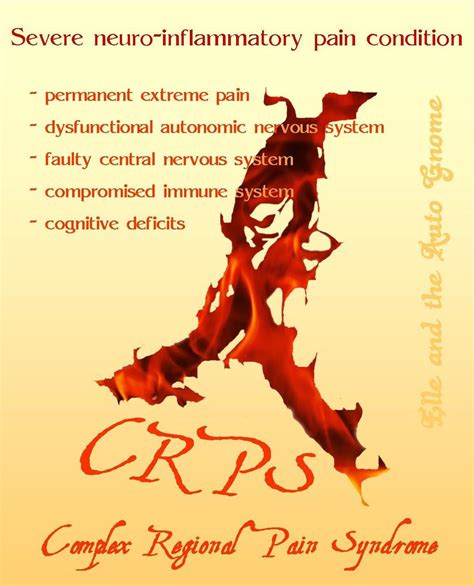 Crps Signs And Symptoms Artofit