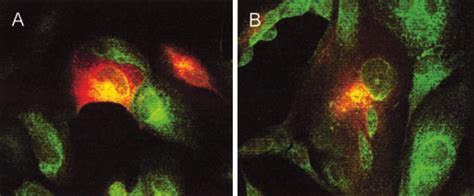 Comparing The Subcellular Localization Of Wild Type And Deletion