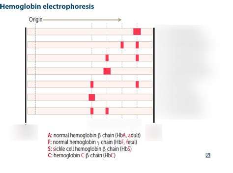 Hemoglobin Electrophoresis Diagram Quizlet 47 OFF