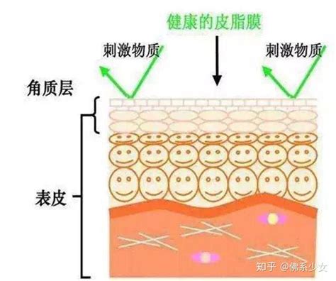 关于皮肤屏障受损 知乎