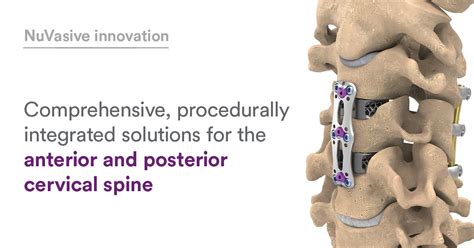 nuvasive  linkedin   nuvasive  portfolio encompassing