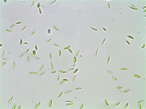 Help To Classify Two Small Unicellular Green Algae