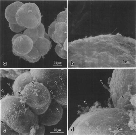 Scanning Electron Micrographs Of Suspension Cultures Ofd Carota Cells