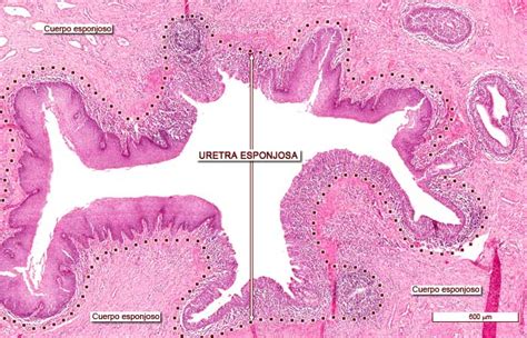 Histología De La Uretra Esponjosa