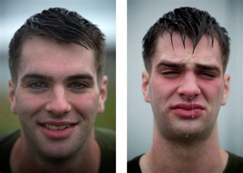 Before And After Portraits Show The Painful Reality Of Oc Spray