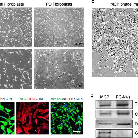 Isolation And Characterization Of Fibroblasts From Human Tunica