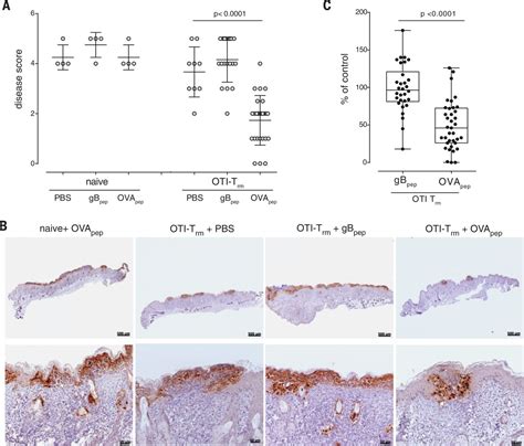 Skin Resident Memory Cd8 T Cells Trigger A State Of Tissue Wide