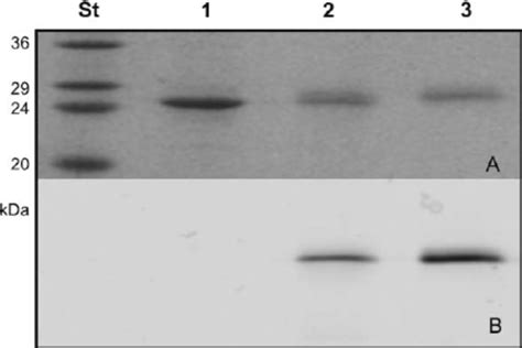 Labeling Efficiency Can Be Calculated By Gel Electrophoresis Equal Download Scientific Diagram