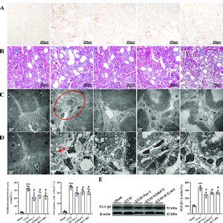 Representative Photomicrographs Of Immunohistochemistry A Masson