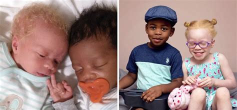 Mom Gives Birth To Black And White Twins And Teaches Them To Embrace