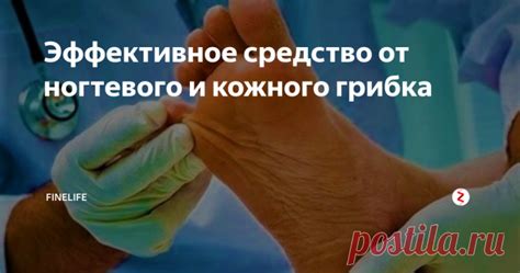 Эффективное средство от ногтевого и кожного грибка Дерматолог пореко ...