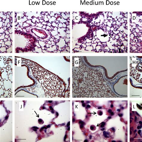 Lung Histology Representative He And Trichrome Stained Lung Tissue