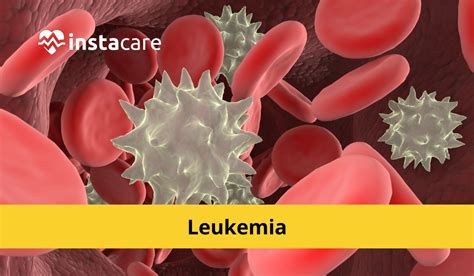 What Is Leukemia Symptoms Signs Causes Types And Treatment