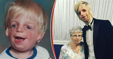 The Remarkable Story Of Jono Lancaster Is An Inspiration To Us All