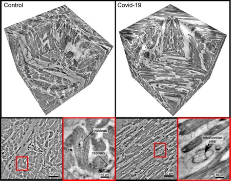 Heart Tissue Healthy Or Affec Image Eurekalert Science News Releases