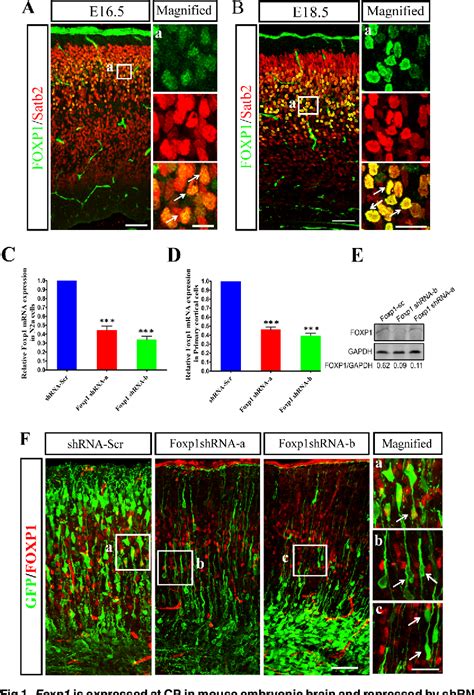 Figure 1 From Foxp1 Regulates Cortical Radial Migration And Neuronal