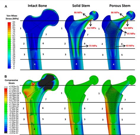 Pdf A Novel Hybrid Design And Modelling Of A Customised Graded Ti Al