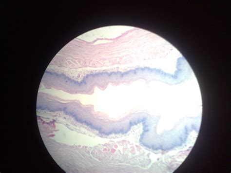 Esophagus – howMed