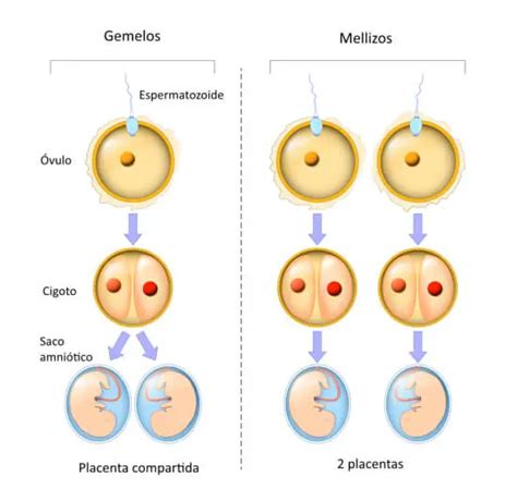 Cu L Es La Diferencia Entre Gemelos Y Cuates Bien Explicado