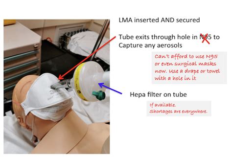 Hepa Filter Bvm