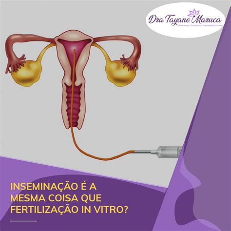 Insemina O A Mesma Coisa Que Fertiliza O In Vitro Dra Tayane Maruca