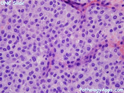 Plasma Cells Histology