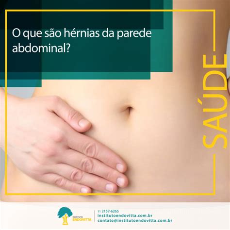 O Que S O H Rnias Da Parede Abdominal Instituto Endovitta