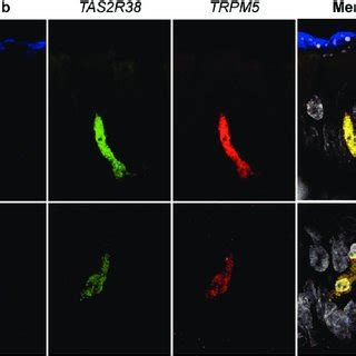 RNAscope In Situ Hybridization Labels A Rare Population Of Elongated