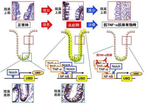 炎症性腸疾患の腸上皮における新たな炎症再生応答の協調機構を解明早期の治療効果予測に期待 テックアイ生命科学