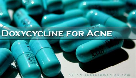 How to Use Doxycycline for Acne - Skin Disease Remedies